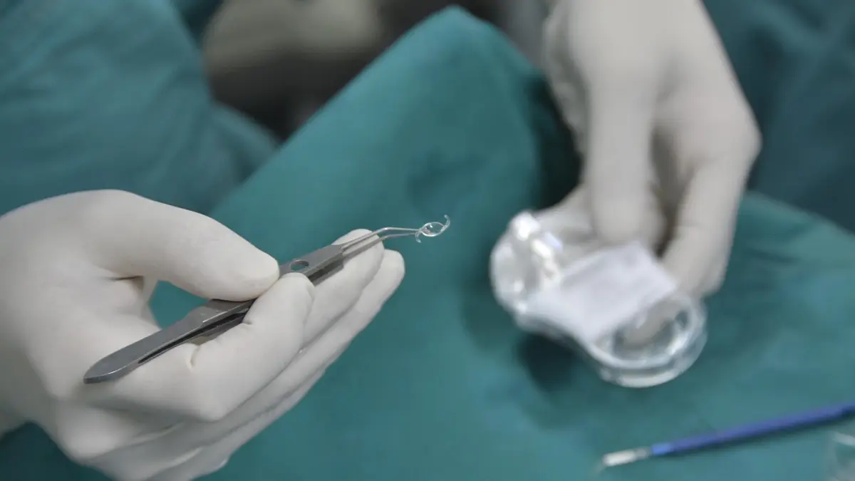 A folded intraocular lens used in cataract surgery.