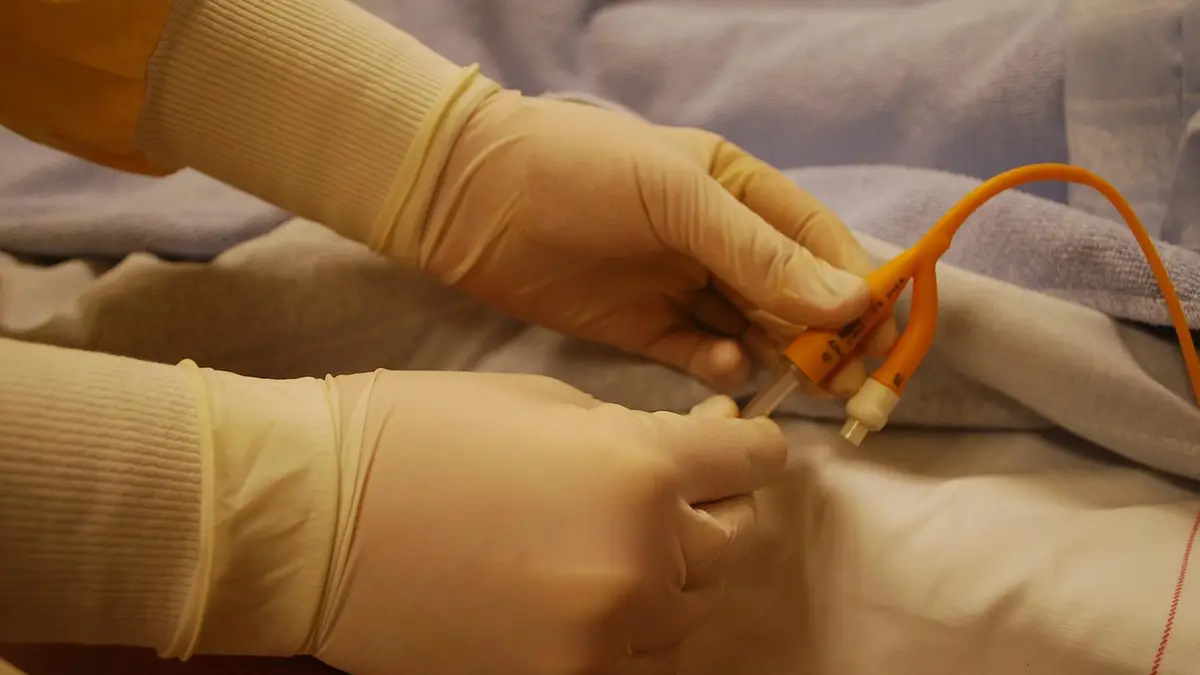 Gloves and a yellow catheter used in healthcare.